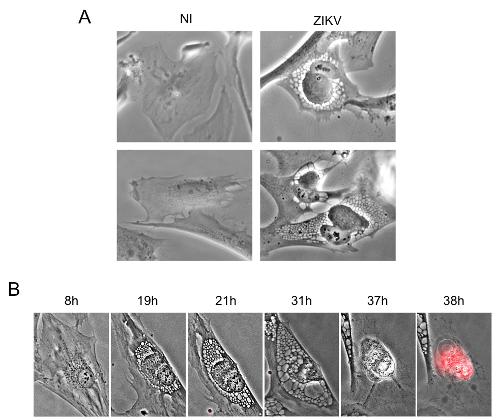 Le Virus Zika Modifie La Morphologie Des Cellules Jusqu’à L’implosion ...